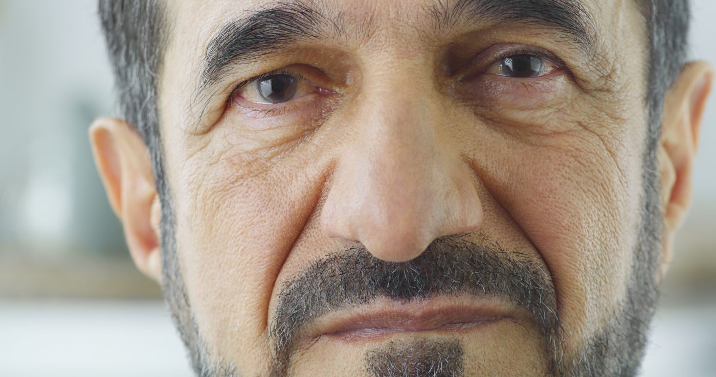 Deutsches Nasenzentrum Rhinoplastik Arabische Nasenform scaled